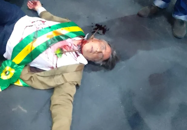 Encenação de atentado contra Bolsonaro
