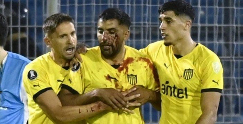 Jogador do Peñarol é atingido por pedra